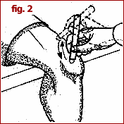 Immagine che mostra l'applicazione di moxa descritta per fig.2